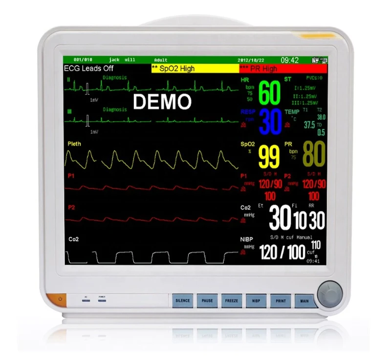 Veterinary Multi-Parameter Monitor Veterinary Multi-Parameter Monitor