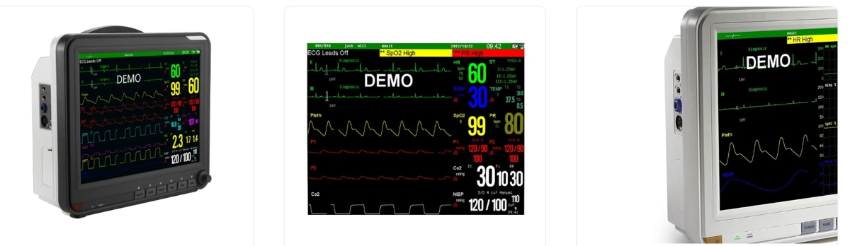 Veterinary Multi-Parameter Monitor Veterinary Multi-Parameter Monitor